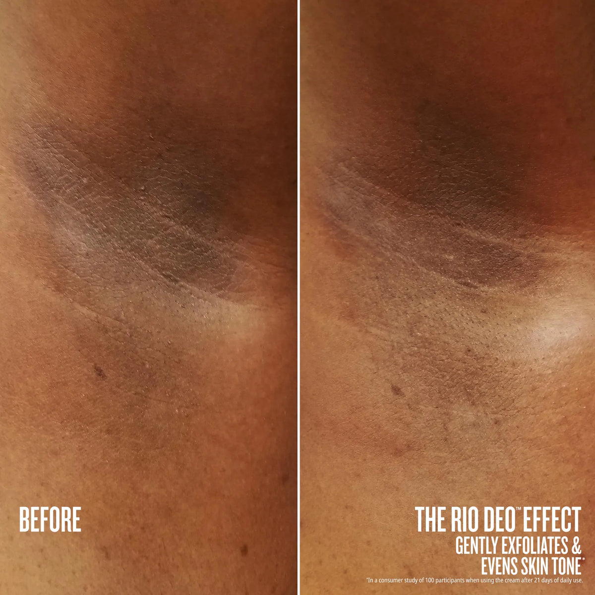 before // after the rio deo effect